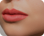 تزریق فیلر لب متد روسی - بعد از درمان